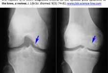 JLSB-11Aprl-2019_-the_knee