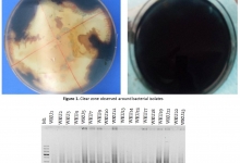 Enset_wilt_causing_bacteria_using_16S_rRNA_Gene_Sequence